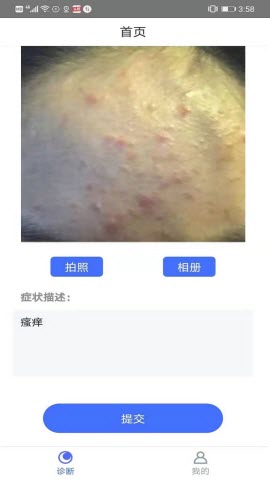 皮肤病在线拍照自测app